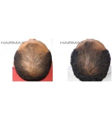 HairMax - Professional lasercombe 12